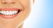 Blanquear los dientes, ¿en que consiste? - comoblanqueardientes.org