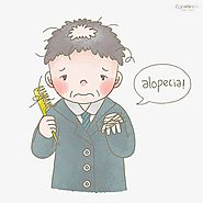 Types of Alopecia Universalis