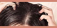 Best Treatment For Alopecia Universalis in India