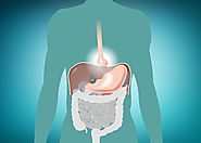 علاج فتق الحجاب الحاجز | دكتور وائل شعلان