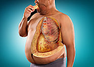 تعرف علي مضاعفات ومخاطر السمنة | دكتور وائل شعلان