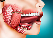جراحات الغدد اللعابية | دكتور وائل شعلان