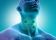 جراحات الغدد اللمفاوية | دكتور وائل شعلان