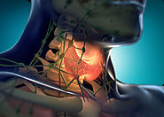 جراحات الغدة الدرقية | دكتور وائل شعلان