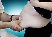 أسباب السمنة المفرطة | دكتور وائل شعلان