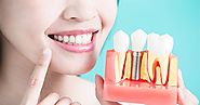 Good Oral Health Offers An Everlasting Smile Bringing In A Better Feel