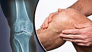 treatment of arthritis, knee pain treatment | Our Health Tips