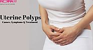 Uterine polyps - Causes, symptoms and treatment for this problem 