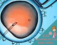 A start to end guide of ICSI Process: In Vitro fertilization with ICSI