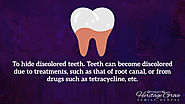 • To hide discolored teeth. Teeth can become discolored due to treatments, such as that of root canal, or from drugs ...