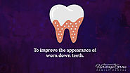 • To improve the appearance of worn down teeth.