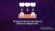 • To improve the size and shape of broken or chipped teeth.