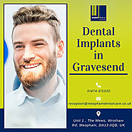 Dental Implants in Gravesend