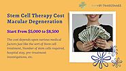 Age-Related Macular Degeneration (AMD), Eyes Stem Cell Treatment Cost in India - MedAcess