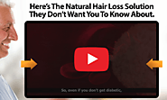 Ultra Fx10 Review - Natural Formula To Prevent Hair Loss!!