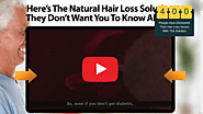 Ultra FX10 Review - Vanish Your Hair Loss Triggers!!