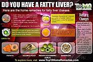 Alcoholic Fatty Liver Disease | Alcohol.org