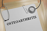 Will I Receive SSDI Disability or SSI for Osteoarthritis?
