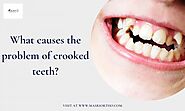 What causes the problem of crooked teeth?