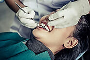When Should One Consider Taking Orthodontic Treatment?