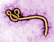 Consideraciones éticas sobre el uso de intervenciones no registradas en la enfermedad por el virus del Ebola (EVE)