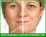 Best Home Remedies to Get Rid of Wrinkles Fast