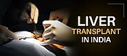 Liver Transplant in India - Fortis Memorial Research Institute