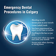 Emergency dental Procedures in Calgary