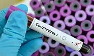 హైదరాబాద్‌లో బీజేపీ ముఖ్యనేతకు కరోనా పాజిటివ్ | Telangana BJP Leader tests positive for coronavirus