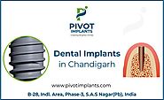 Dental Implant in Chandigarh