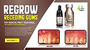 Gingivitis Gum Regrowth
