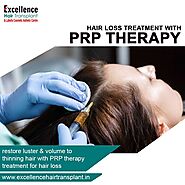 PRP Treatment in Vadodara