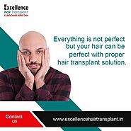 Excellence Hair Transplant