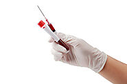 10-day Early Detection HIV DNA Testing