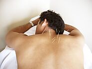How Acupuncture And Hypnosis Is Helpful In Quitting Addiction?