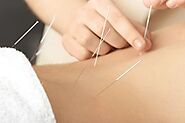 How Can Acupuncture Be Beneficial For Addiction Treatment?