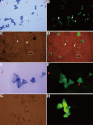 Deterioration-Associated Microbiome of Stone Monuments: Structure, Variation, and Assembly