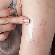Eczema Specialist In Lansing and Mt. Pleasant