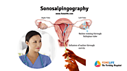 Sonosalpingography Procedure, Cost, Advantages | FEMELIFE