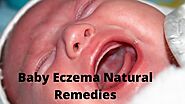 10 Most Common Baby Eczema Natural Remedies » Babyrashinfo