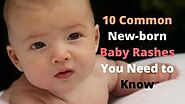 10 Types Of Most Common Rashes In Newborns And Babies » Babyrashinfo