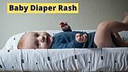 Diaper Rash Treatment, Best Remedies, And Related Cream » Babyrashinfo