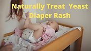 Yeast Diaper Rash Causes & Best Treatment That Really Helps Fast » Babyrashinfo