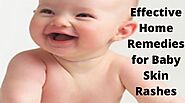 14 Effective Home Remedies For Baby Skin Rashes » Babyrashinfo