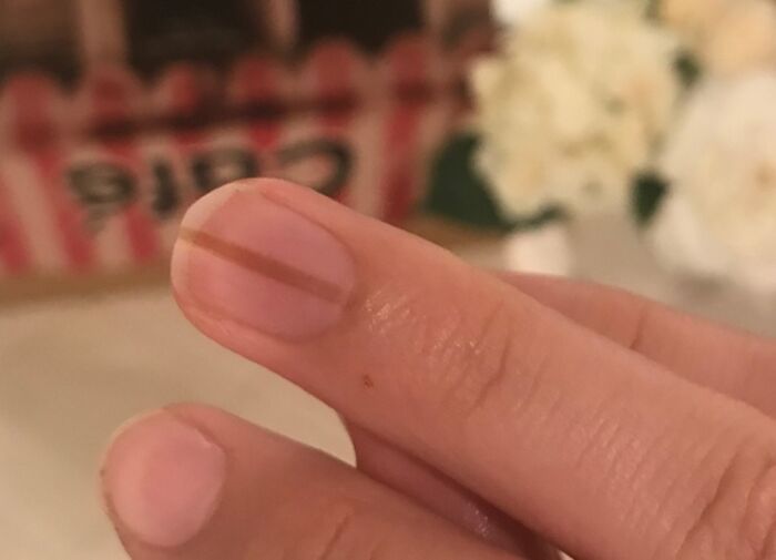 What Do Brown Nails Mean