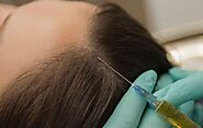 Best Hair Fall Treatment Doctor in Ludhiana | Hair Loss Treatment Cost in Ludhiana