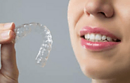 Discover Your Perfect Smile: Prime Dental's Premier Invisalign Services