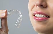 Unlocking Affordable Invisalign Treatment: A Comprehensive Guide
