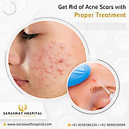How to Get a Flawless Skin with Acne Scar Treatment?