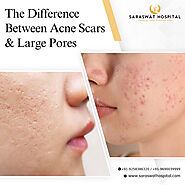 How to Differentiate Between Acne Scars and Large Pores?